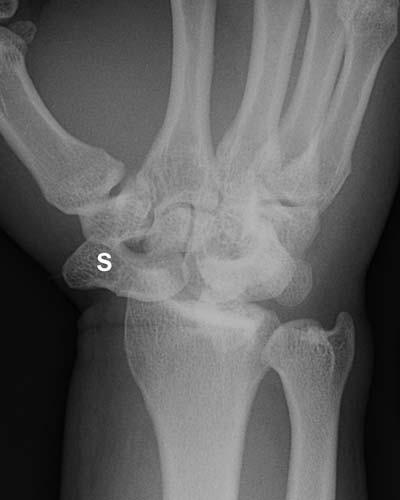 Radiologic Image