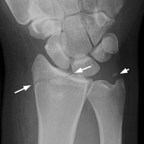 Radiologic Image