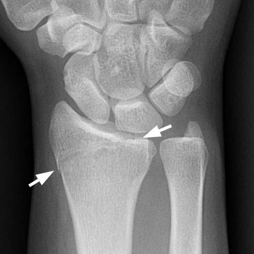 Radiologic Image