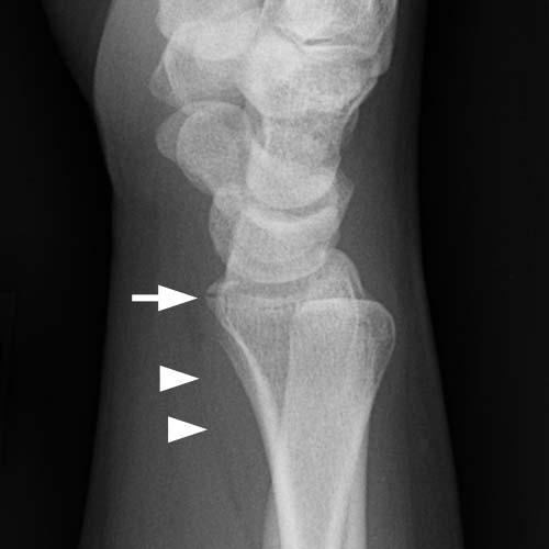 Radiologic Image