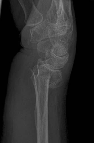 Radiologic Image