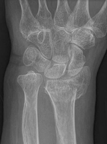 Radiologic Image