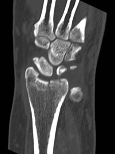 Radiologic Image