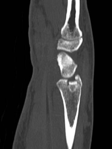 Radiologic Image