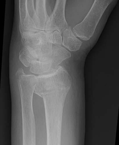 Radiologic Image