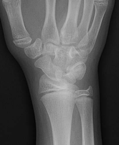 Forearm, Elbow, and Upper Arm | Radiology Key