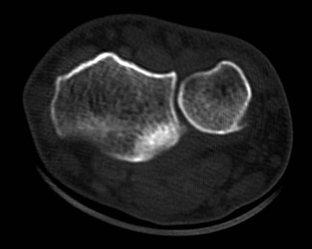 Radiologic Image