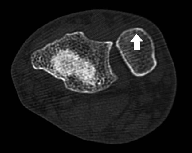 Radiologic Image