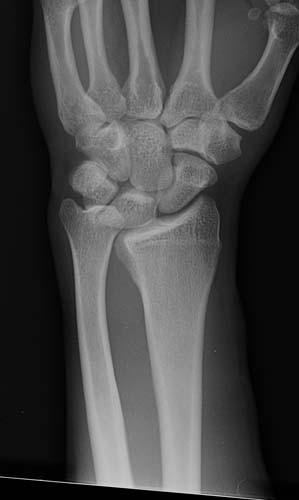 Radiologic Image