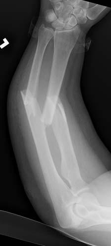 Radiologic Image