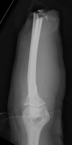 Radiologic Image