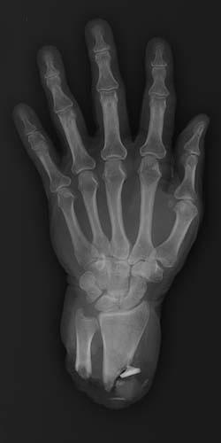 Radiologic Image