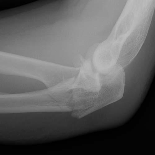 Forearm, Elbow, and Upper Arm | Radiology Key