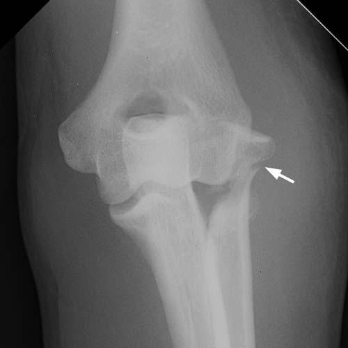 Radiologic Image