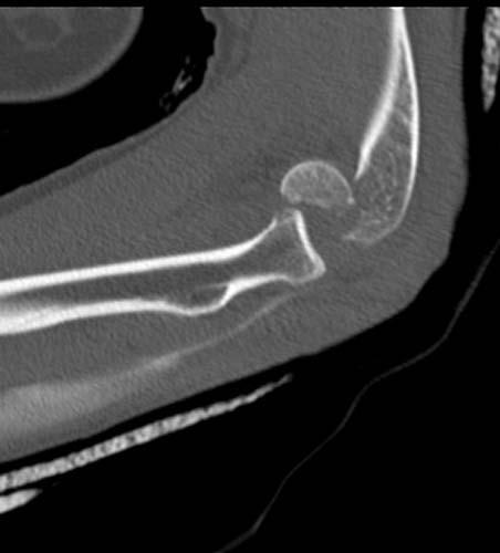 Radiologic Image