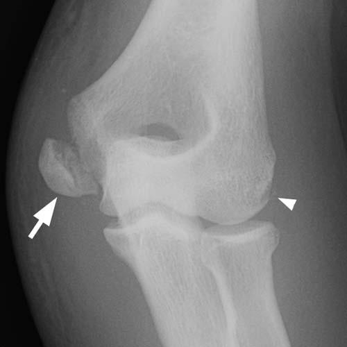 Radiologic Image