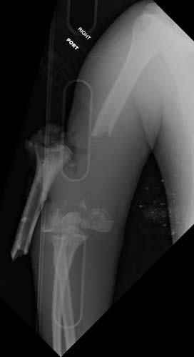 Radiologic Image