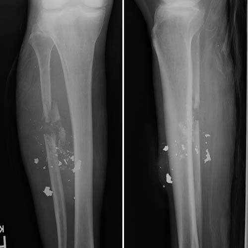 Radiologic Image