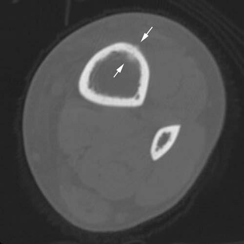 Radiologic Image