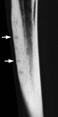 Radiologic Image