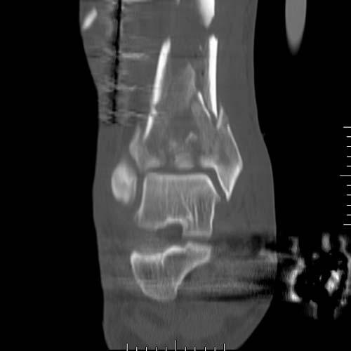 Radiologic Image