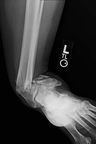 Radiologic Image