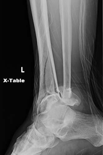 Radiologic Image