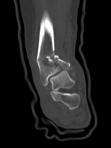 Radiologic Image