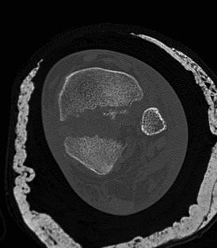 Radiologic Image