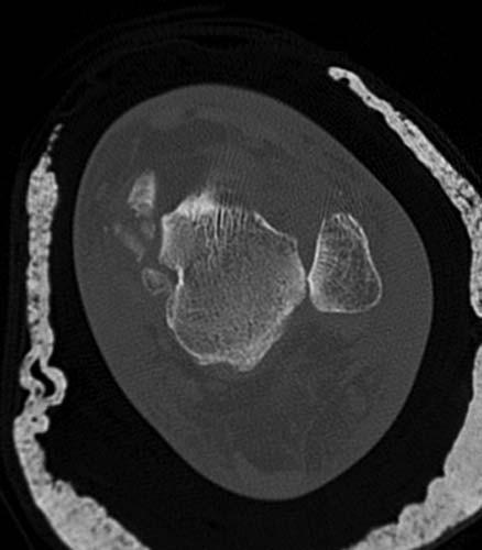 Radiologic Image