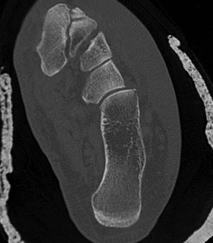 Radiologic Image