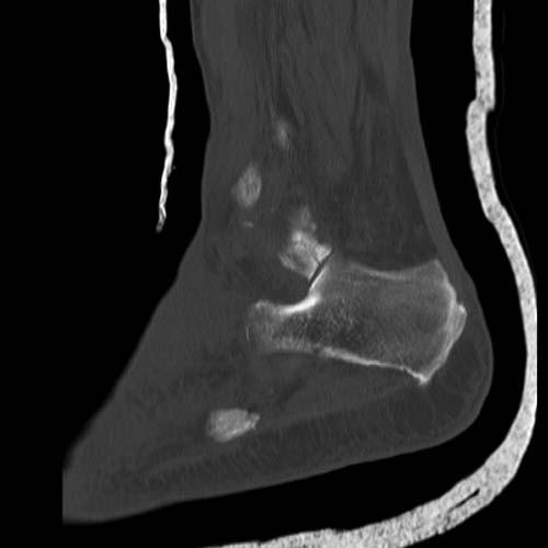 Radiologic Image