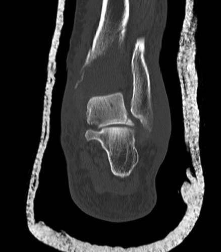 Radiologic Image