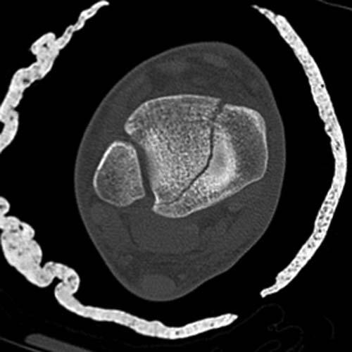 Radiologic Image