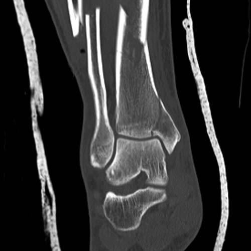 Radiologic Image