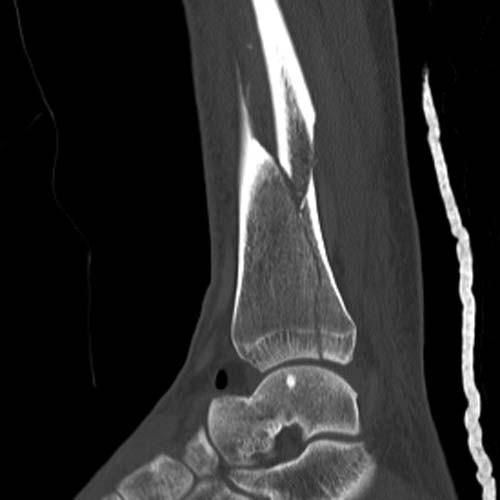 Radiologic Image