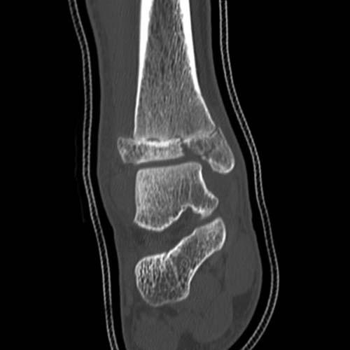 Radiologic Image