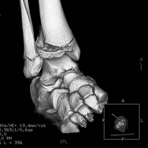 Radiologic Image