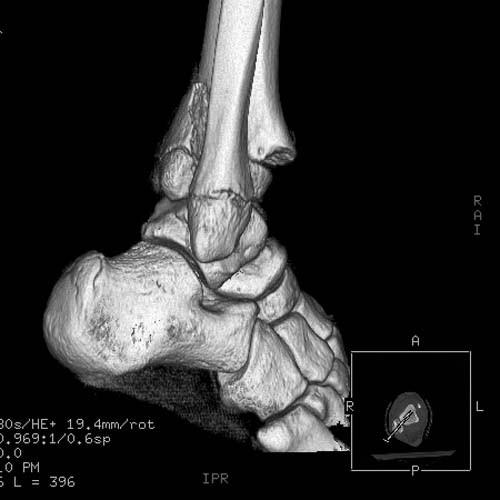 Radiologic Image