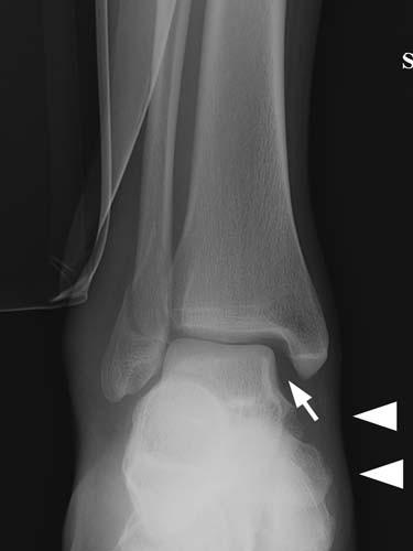 Radiologic Image