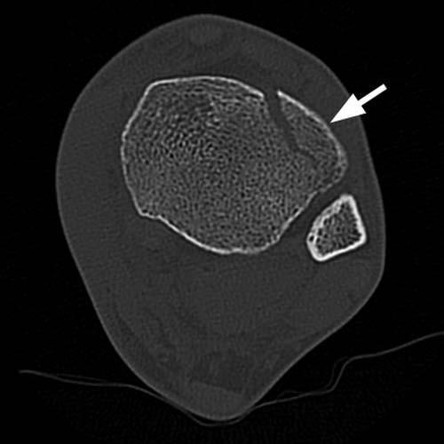 Radiologic Image