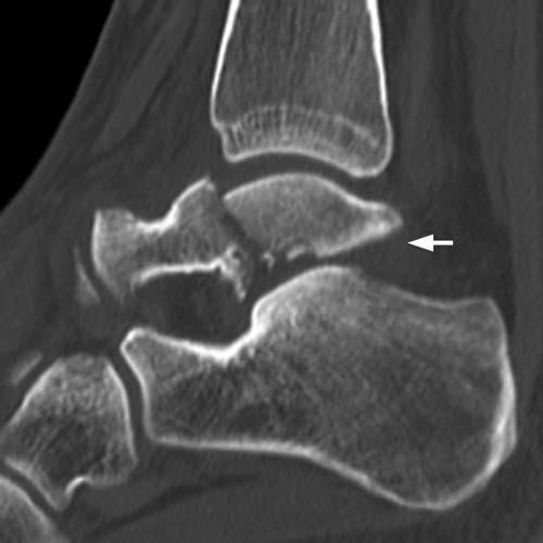 Radiologic Image