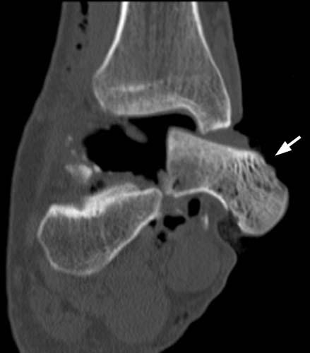 Radiologic Image