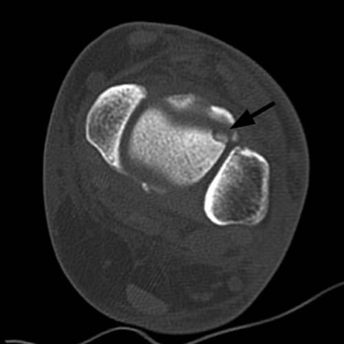 Radiologic Image