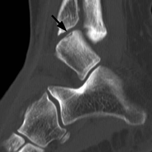 Radiologic Image