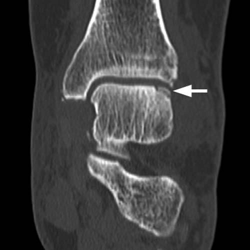 Radiologic Image