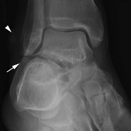 Radiologic Image