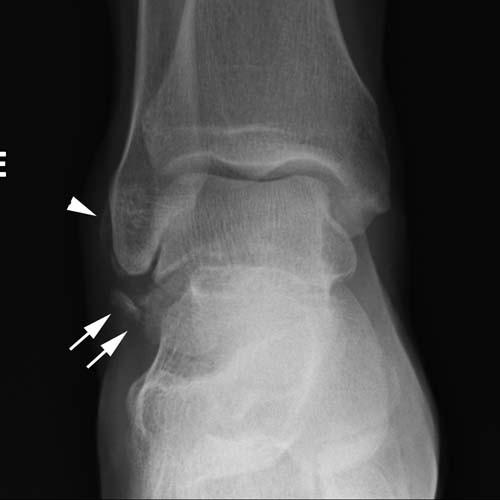 Radiologic Image