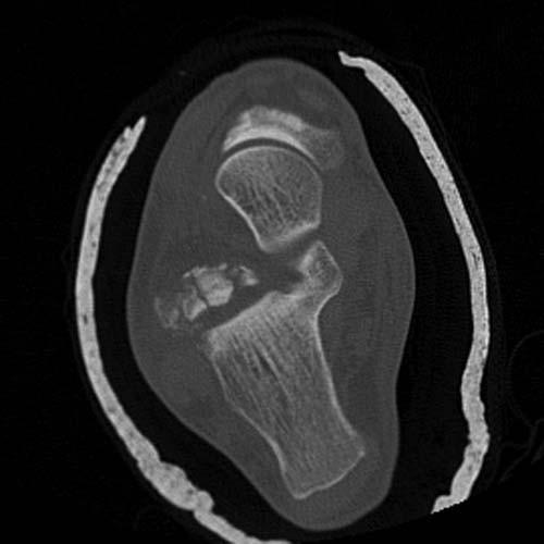 Radiologic Image