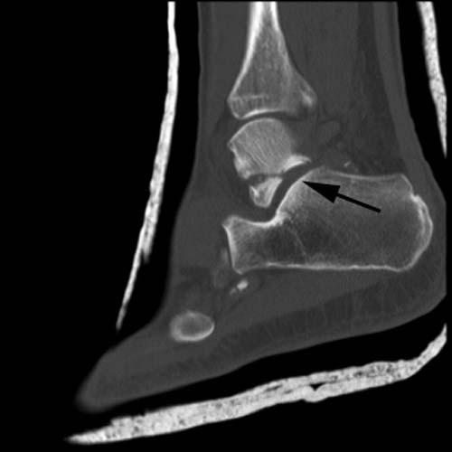 Radiologic Image